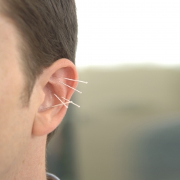 Man with acupuncture needles in his ear